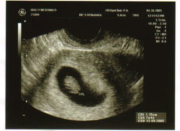 babyfirstpic.jpg